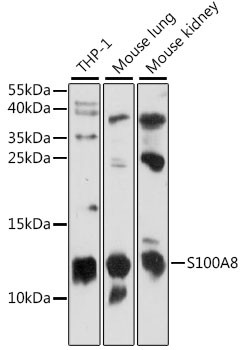 S100A8 Antibody in Western Blot (WB)