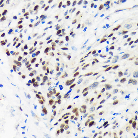 WDHD1 Antibody in Immunohistochemistry (Paraffin) (IHC (P))