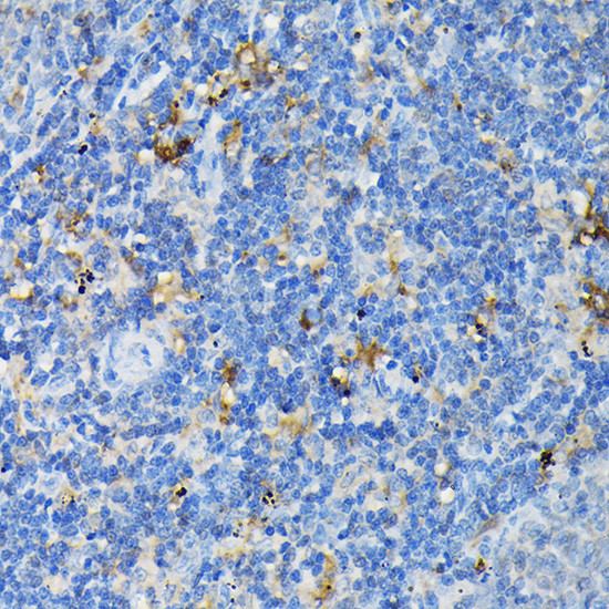 TNFR1 Antibody in Immunohistochemistry (Paraffin) (IHC (P))