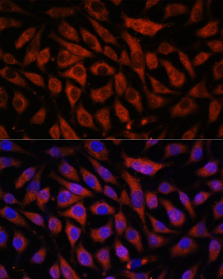 STK38L Antibody in Immunocytochemistry (ICC/IF)