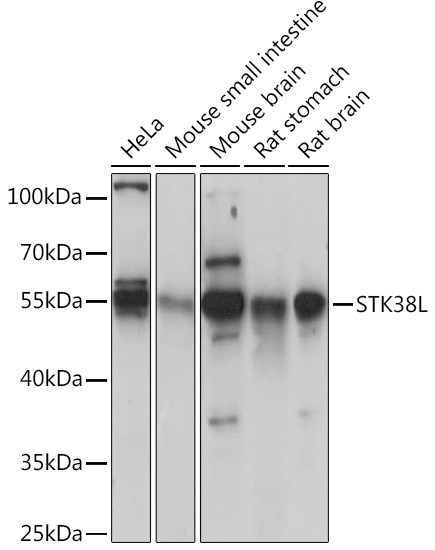 STK38L Antibody in Western Blot (WB)