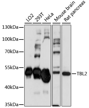 TBL2 Antibody in Western Blot (WB)