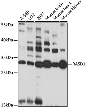 RASD1 Antibody in Western Blot (WB)