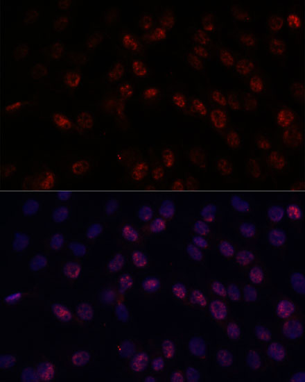 DDX24 Antibody in Immunocytochemistry (ICC/IF)