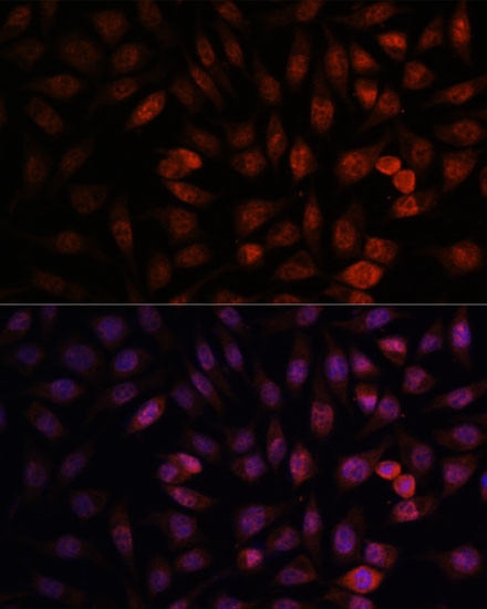 DDX24 Antibody in Immunocytochemistry (ICC/IF)