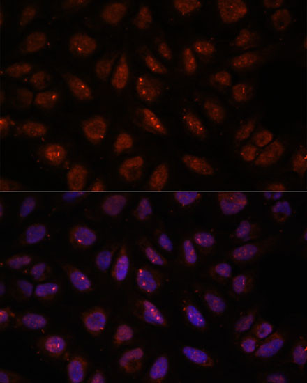 DDX24 Antibody in Immunocytochemistry (ICC/IF)