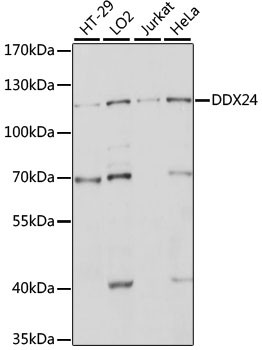 DDX24 Antibody in Western Blot (WB)