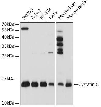 Cystatin C Antibody in Western Blot (WB)