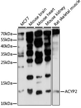 ACYP2 Antibody in Western Blot (WB)