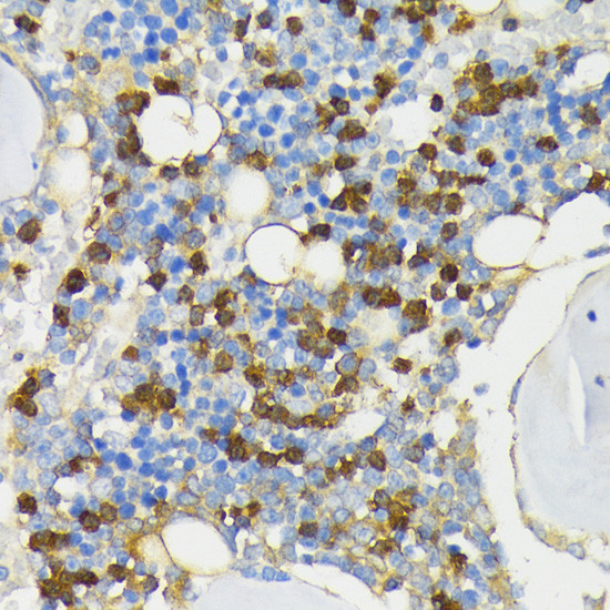 Cathelicidin Antibody in Immunohistochemistry (Paraffin) (IHC (P))