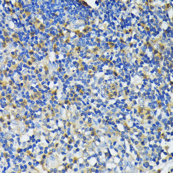 Cathelicidin Antibody in Immunohistochemistry (Paraffin) (IHC (P))