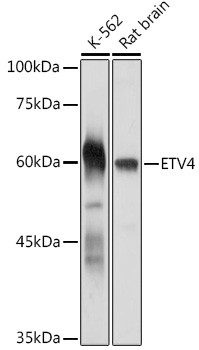 ETV4 Antibody in Western Blot (WB)