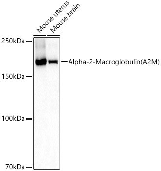 A2M Antibody in Western Blot (WB)