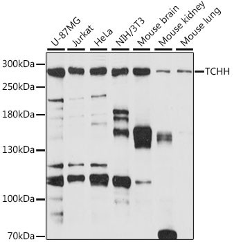 TCHH Antibody in Western Blot (WB)