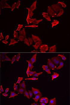 SKAP2 Antibody in Immunocytochemistry (ICC/IF)