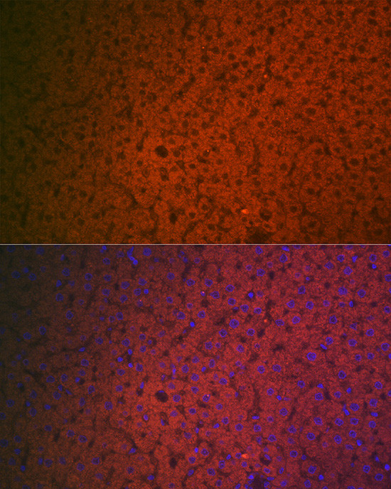 Factor IX Antibody in Immunocytochemistry (ICC/IF)