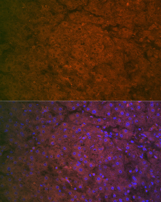 Factor IX Antibody in Immunocytochemistry (ICC/IF)