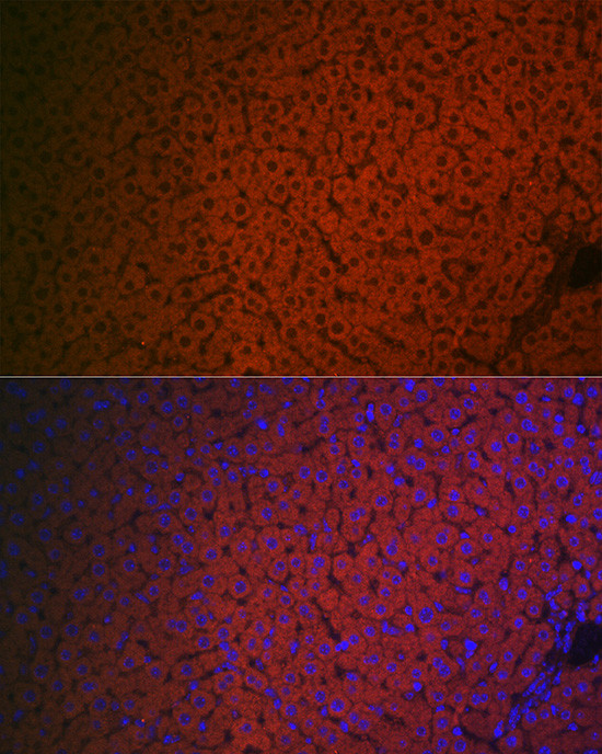 Factor IX Antibody in Immunocytochemistry (ICC/IF)