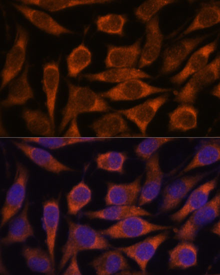 ME3 Antibody in Immunocytochemistry (ICC/IF)