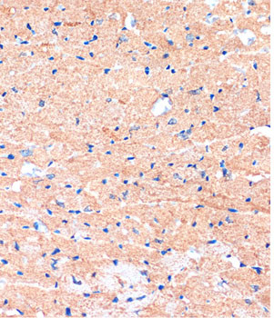 ME3 Antibody in Immunohistochemistry (Paraffin) (IHC (P))