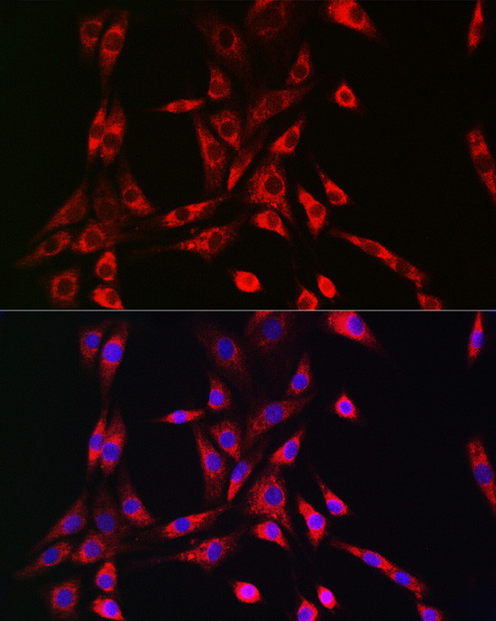 PIK3R4 Antibody in Immunocytochemistry (ICC/IF)