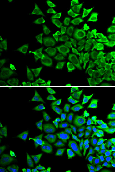 BAD Antibody in Immunocytochemistry (ICC/IF)