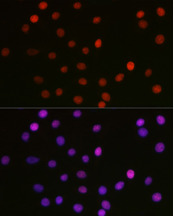 Acetyl-HMGB1 (Lys29) Antibody in Immunocytochemistry (ICC/IF)