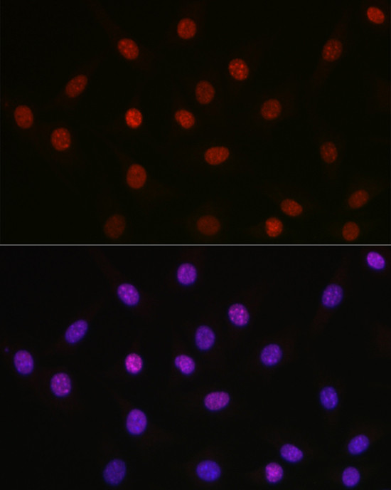 Acetyl-HMGB1 (Lys29) Antibody in Immunocytochemistry (ICC/IF)