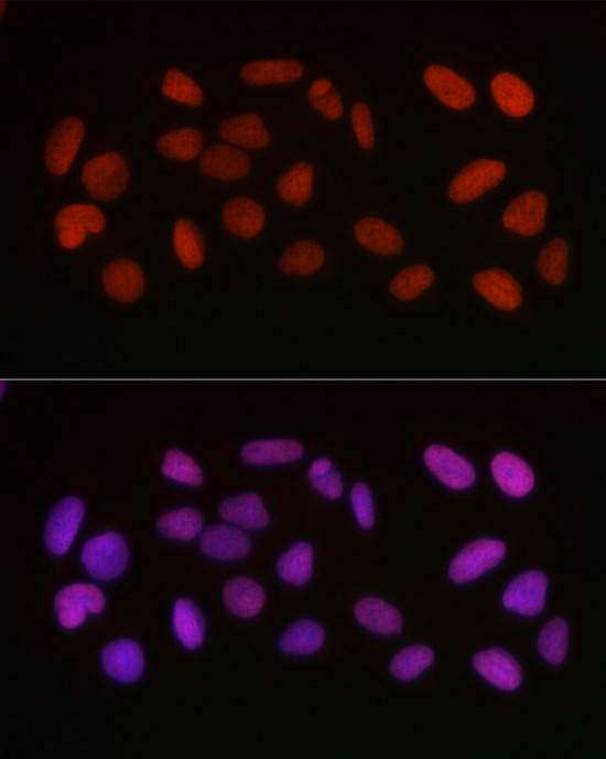 Acetyl-HMGB1 (Lys29) Antibody in Immunocytochemistry (ICC/IF)