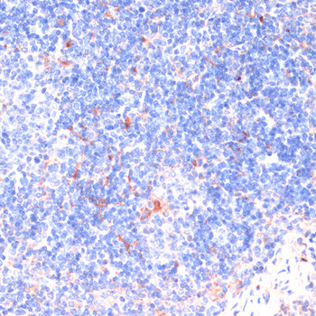 ZNRF3 Antibody in Immunohistochemistry (Paraffin) (IHC (P))