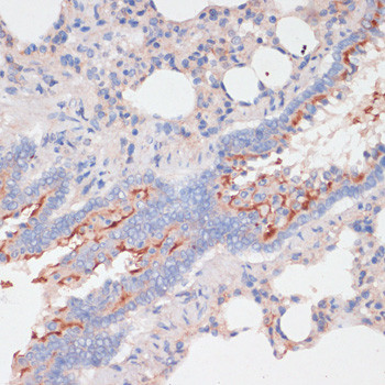 ZNRF3 Antibody in Immunohistochemistry (Paraffin) (IHC (P))