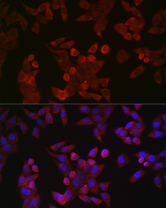 Cyclin B1 Antibody in Immunocytochemistry (ICC/IF)