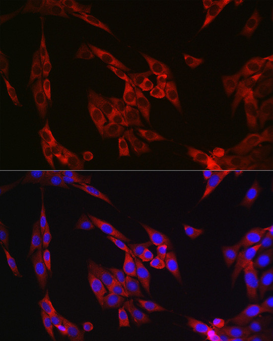 Cyclin B1 Antibody in Immunocytochemistry (ICC/IF)