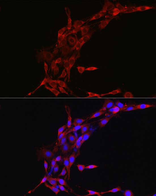 Cyclin B1 Antibody in Immunocytochemistry (ICC/IF)