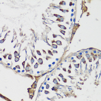 Cyclin B1 Antibody in Immunohistochemistry (Paraffin) (IHC (P))