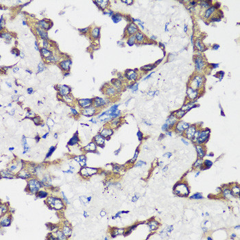 Cyclin B1 Antibody in Immunohistochemistry (Paraffin) (IHC (P))