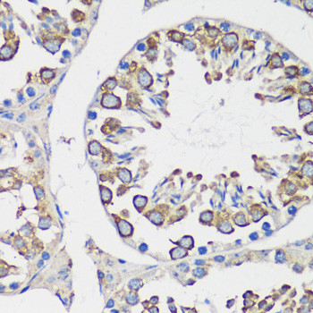 Cyclin B1 Antibody in Immunohistochemistry (Paraffin) (IHC (P))