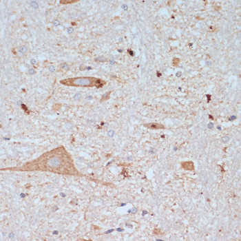 VAChT Antibody in Immunohistochemistry (Paraffin) (IHC (P))