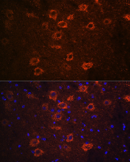 VAChT Antibody in Immunohistochemistry (Paraffin) (IHC (P))