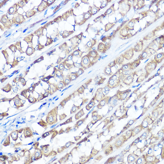 TRPV6 Antibody in Immunohistochemistry (Paraffin) (IHC (P))