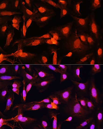 SGOL1 Antibody in Immunocytochemistry (ICC/IF)