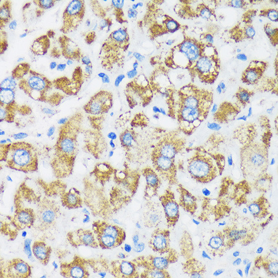 GTPBP8 Antibody in Immunohistochemistry (Paraffin) (IHC (P))