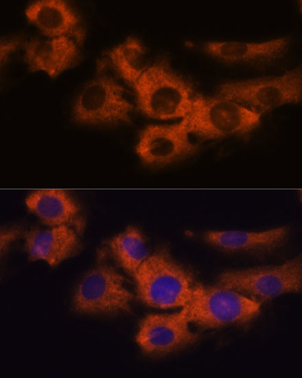 NDRG4 Antibody in Immunocytochemistry (ICC/IF)