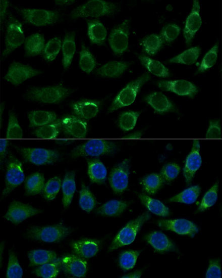 ALDH3A2 Antibody in Immunocytochemistry (ICC/IF)