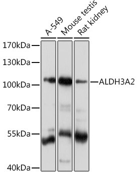 ALDH3A2 Antibody in Western Blot (WB)