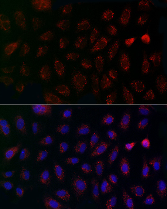 MCU Antibody in Immunocytochemistry (ICC/IF)