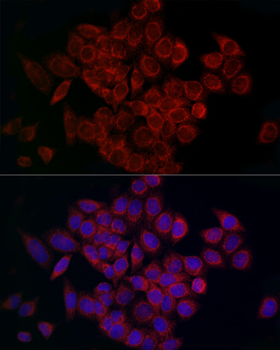 MCU Antibody in Immunocytochemistry (ICC/IF)