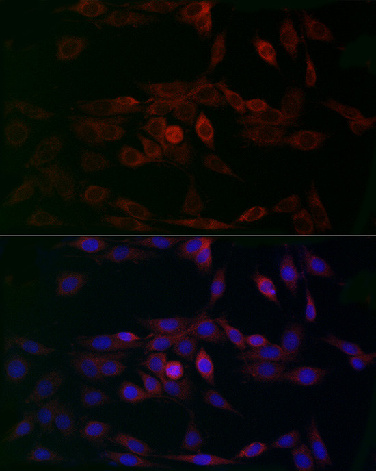 MCU Antibody in Immunocytochemistry (ICC/IF)