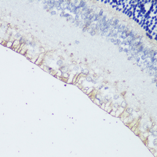 Opsin 4 Antibody in Immunohistochemistry (Paraffin) (IHC (P))