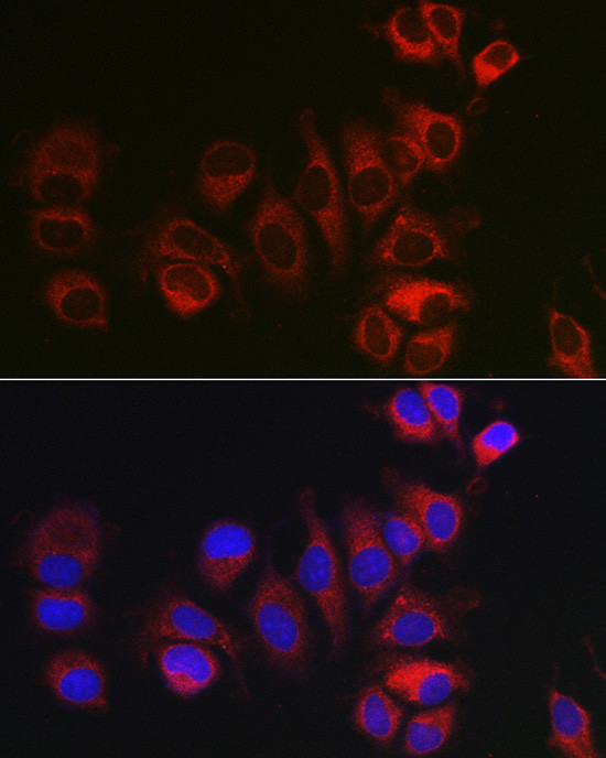 BOK Antibody in Immunocytochemistry (ICC/IF)